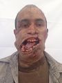 Unused prosthetics for a dead Filipino miner